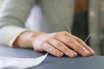 Hand and Finger Acupuncture
