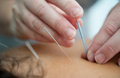 acupuncture for pain, Addiction medicine with acupuncture and Traditional Chinese Medicine.